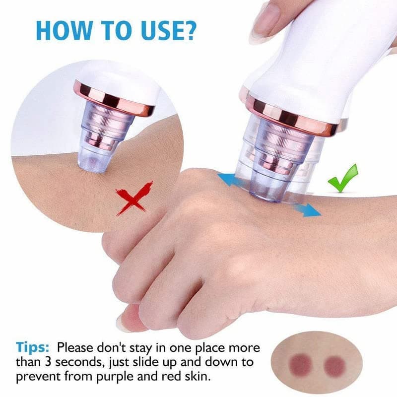 Blackhead Removal Machine – Skin Care & Pore Cleaner